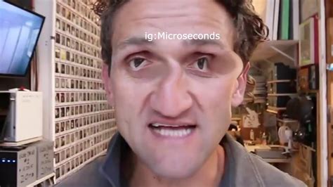 casey neistat no glasses.